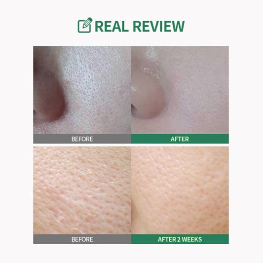 Sérum à la tomate verte resserre les pores