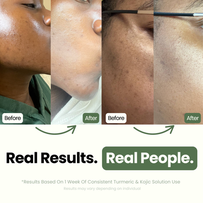 Solution Curcuma et Kojic